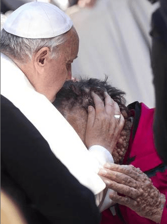 2013 Pope Francis embracing, blessing, and kissing a man with a skin disease